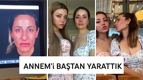 Paylaşımlarıyla Tartışma Yaratan Mika Can Raun, Annesine Yaptırdığı Estetiklerle Gündem Oldu