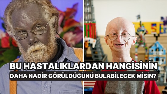 Bu Hastalıklardan Hangisinin Daha Nadir Görüldüğünü Bulabilecek misin?