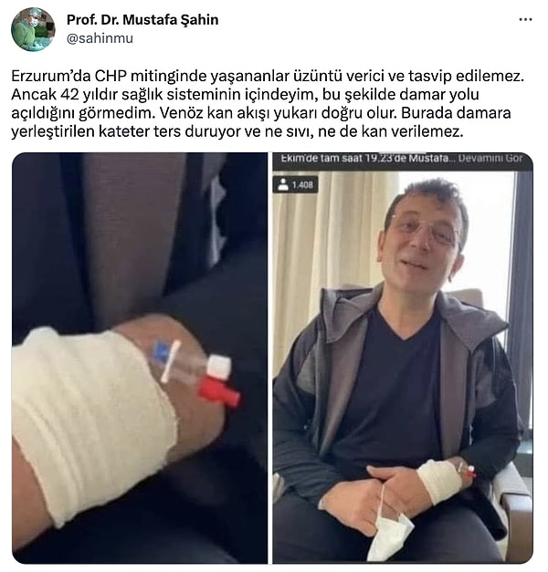 Tabii yalan bilgilerle algı oluşturmaya çalışanlar da maalesef ki oldu. Doktor olan bir kullanıcı, İmamoğlu'nun covid olduğu dönemde çekilen eski bir fotoğrafını yayınlayarak, İmamoğlu'nu yalancı olmakla suçladı. "42 yıldır sağlık sisteminin içindeyim, bu şekilde damar yolu açıldığını görmedim." ifadeleriyle fotoğraftaki damar yolunun yanlış olduğunu söyledi.