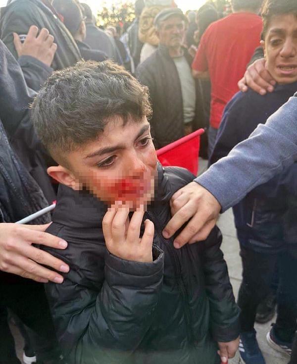 Yaşananlara tepki yağarken; Cumhurbaşkanlığı Sözcüsü İbrahim Kalın, Habertürk'te taşlı saldırı için "Fotoğrafa da bakmak lazım" dedi.