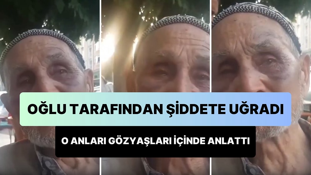 Sarhoş Oğlu Tarafından Şiddete Uğrayan Babanın O Olayı Gözleri Dolarak Anlattığı Anlar