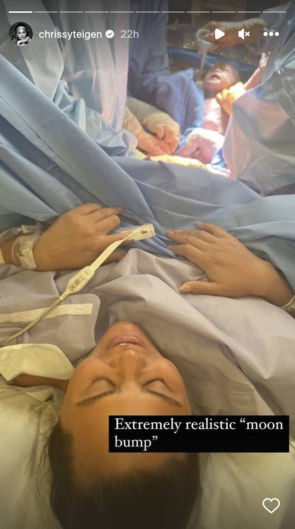 "Чрезвычайно реалистичный "накладной живот"", - подписала Крисси фотографию.