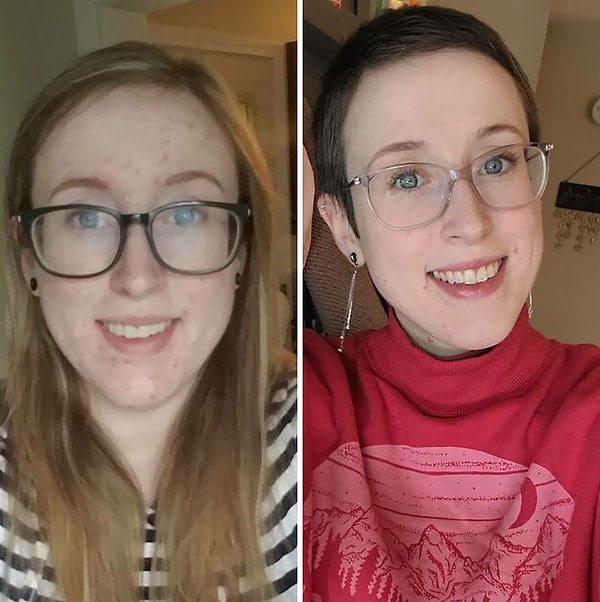 9. «Мой внешний вид, когда я жила с ВИЧ, не зная про него, в течение целых пяти лет, по сравнению с двумя годами лечения»