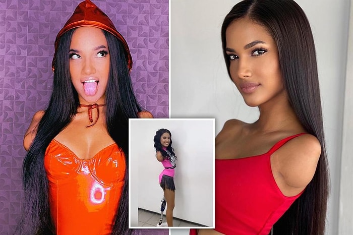 Модель без границ: история тройного ампутанта