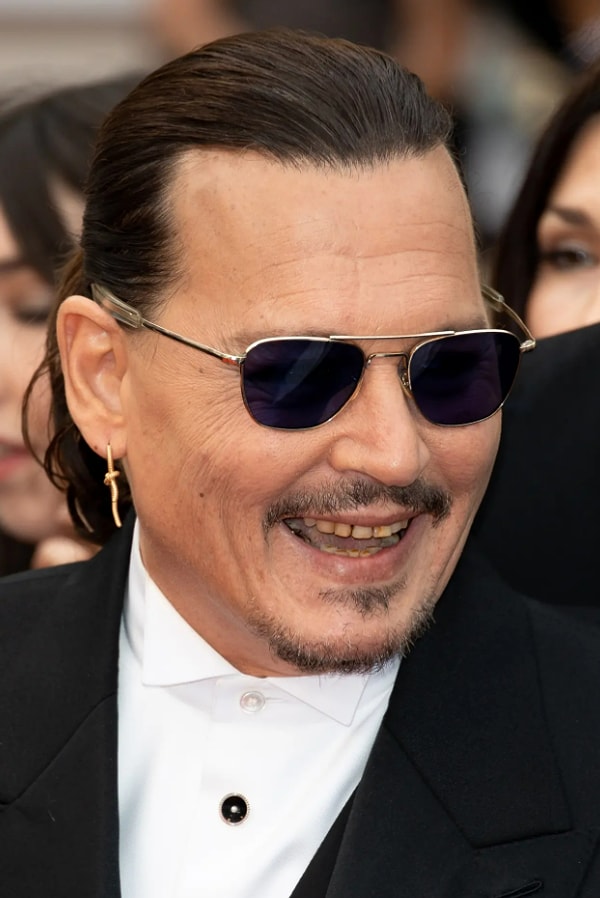 Еще в 1994 году в интервью для журнала Premiere Джонни Депп объяснил, почему не устанавливает виниры, как многие его коллеги