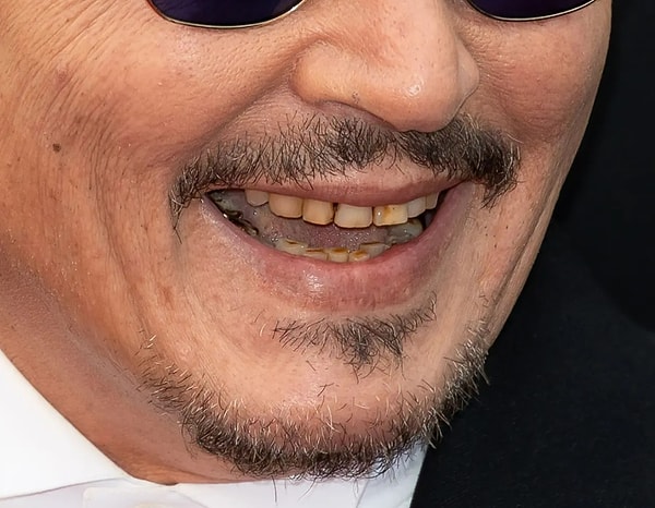 Скорее всего, зубы Деппа находятся в таком плачевном состоянии из-за алкоголя и курения. Поговаривают также, что актер вовсю употребляет запрещенные вещества