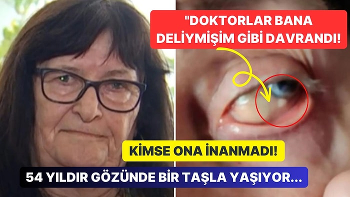 54 Yıl Boyunca Gözünde Bir Taşla Yaşayan Kadından Kan Donduran Açıklamalar: "Doktorlar Beni Deli Sandı!"