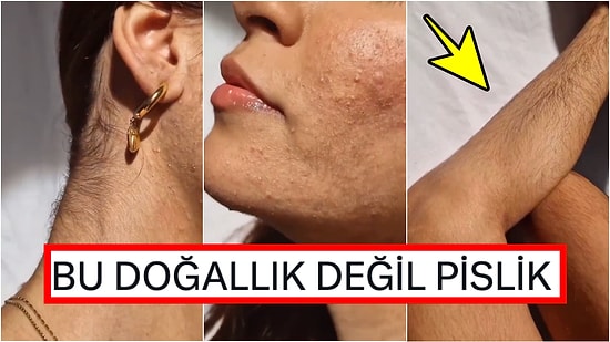 Vücut Kılları Yüzünden Zorbalığa Uğrayan Kadına Gelen Çirkin Yorum Tartışma Başlattı!