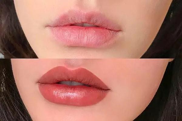 Dudaklara kalıcı bir renk vermek amacıyla yapılan kozmetik bir işlem olan dudak pigmentasyonu, son dönemlerde oldukça popüler hale geldi.