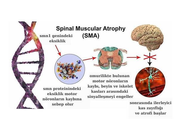 Programda gündeme getirilen sorunlardan biri de Spinal Müsküler Atrofi (SMA) hastaları ve tedavi süreciydi.