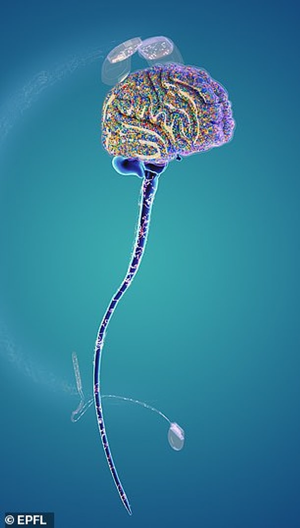 Затем сигналы мозга преобразуются в последовательности электрической стимуляции спинного мозга. В свою очередь, это активирует мышцы ног для достижения желаемого движения.