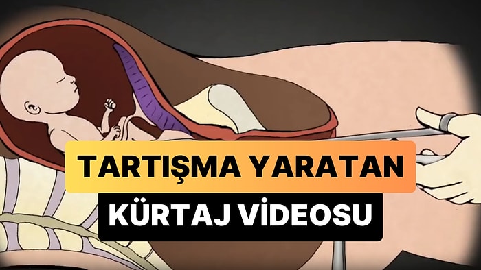 Gelişmiş Bir Bebeğin Kürtaj İşlemini Gösterdiği İddia Edilen Video Tartışma Yarattı