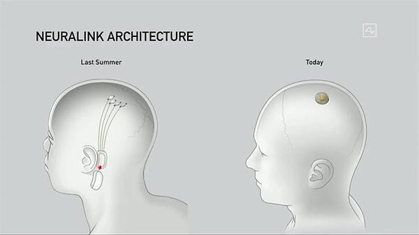 Elon Musk'ın beyin çipi şirketi Neuralink perşembe günü yaptığı açıklamada, implantlarını insan deneklerde test etmek için ABD'de düzenleyici onaya sahip olduğunu söyledi.