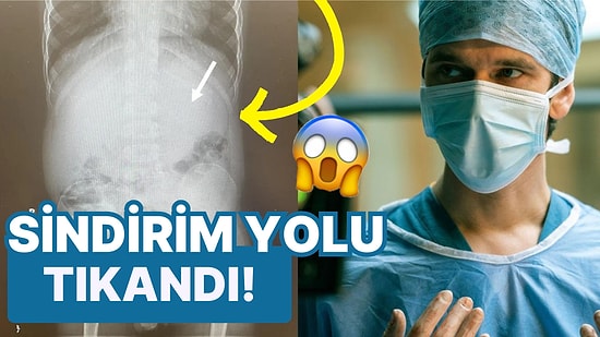 Tıkanıklığa Yol Açtı: 40 Tane Sakız Yutan 5 Yaşındaki Küçük Çocuğun Röntgeni Doktorları Korkuttu!