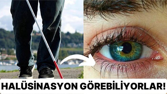 Charles Bonnet Sendromu Nedir ve Görme Yetisini Kaybedenler Neden Halüsinasyon Görür?