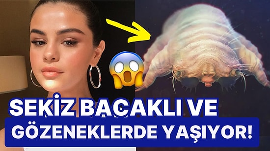 Uzman Dermatolog, Yüzümüzde Yaşayan Minik Böceklerin Olduğunu Söyledi: "Sebumdan Besleniyor..."