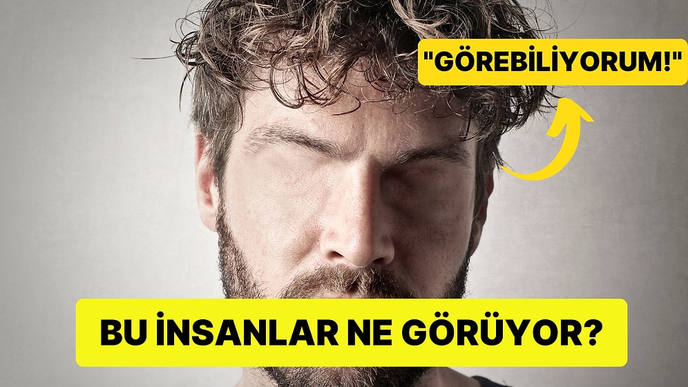Göremediği Halde Görebildiğini İddia Eden İnsanlar: Anton Sendromu Nedir Neden Ortaya Çıkar?