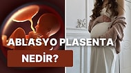 Hamilelik Sürecinde Ebeveynleri Endişelendiren Ablasyo Plasenta Hakkında Merak Ettiklerinizi Anlatıyoruz!