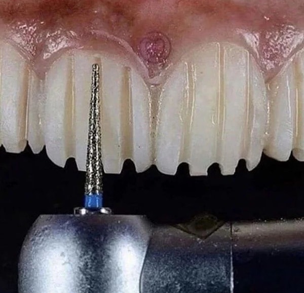 20. Но зачем?