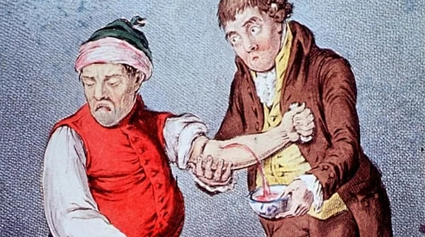 8. Для чего делали кровопускание?