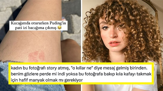 Fenomen Gizem Üzel'in Bacağının Göründüğü Fotoğrafa Gelen "Kıl" Yorumları Sinirlerinizi Bozacak