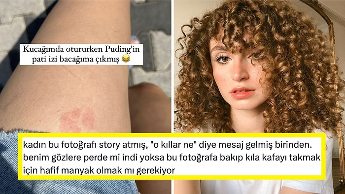 Fenomen Gizem Üzel'in Bacağının Göründüğü Fotoğrafa Gelen "Kıl" Yorumları Sinirlerinizi Bozacak