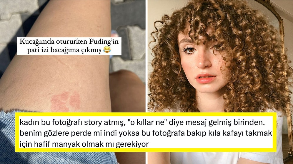 Fenomen Gizem Üzel'in Bacağının Göründüğü Fotoğrafa Gelen "Kıl" Yorumları Sinirlerinizi Bozacak