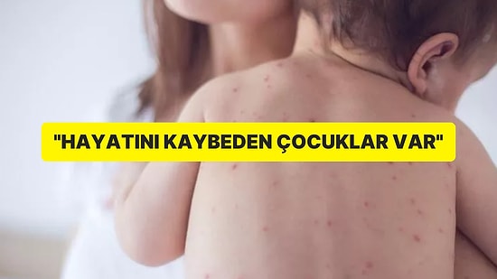 İstanbul Kızamık Alarmı: Hayatını Kaybedenler Var