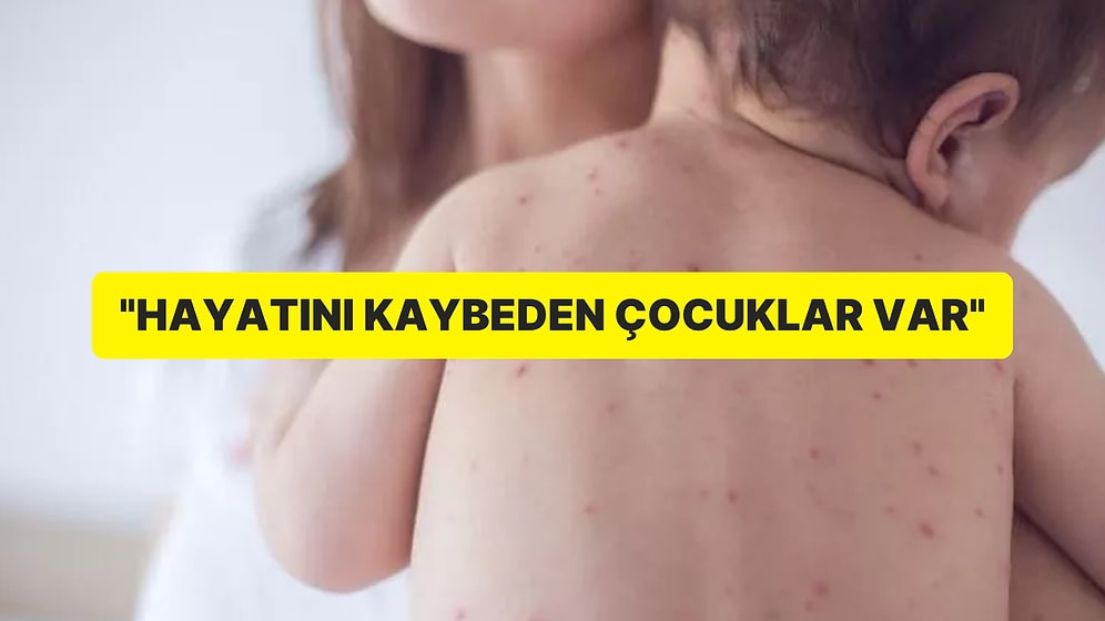 İstanbul Kızamık Alarmı: Hayatını Kaybedenler Var