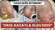10 Haftalık Bebeğini Gündüz Bakımevinden Kanlar İçinde Alan Annenin Açıklamaları:"Kazayla Olduğunu Söylediler"