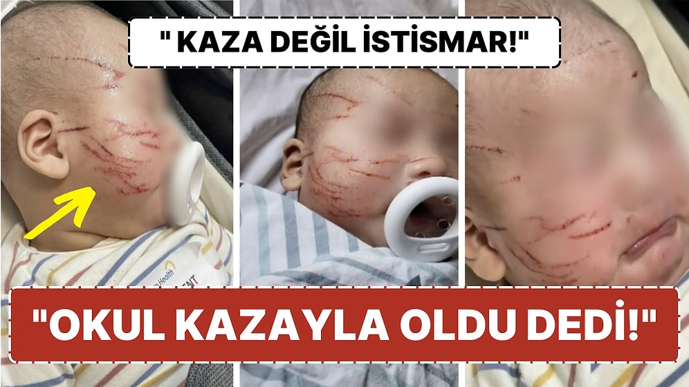 10 Haftalık Bebeğini Gündüz Bakımevinden Kanlar İçinde Alan Annenin Açıklamaları:"Kazayla Olduğunu Söylediler"