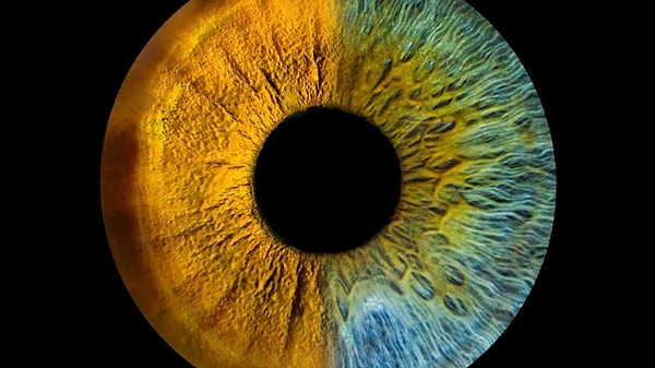 2. Какова функция радужной оболочки?