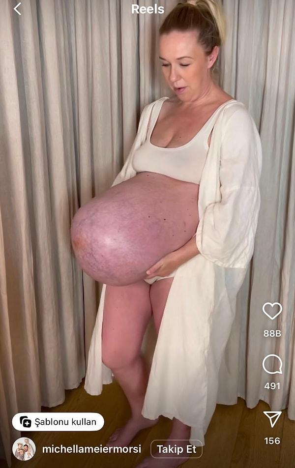 Üçüz bebeklere hamile olan Michella Meier-Morsi, geçtiğimiz günlerde Instagram hesabından paylaştığı videoda karnını böyle göstermişti.