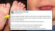 Sebebi "Düzensiz Göç" Olabilir mi? Son Zamanlarda Artan "El Ayak Ağız Hastalığı" Endişelendirdi!