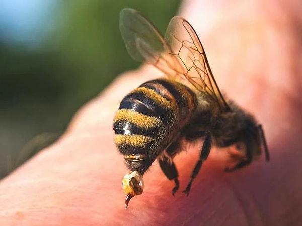 6. Arı sokmaları bazıları için ölümcül olabilir. Genellikle soktukları yerde beyaz bir nokta olur. Bazen iğne takılı kalır ve bunu çıkarmanız gerekir.