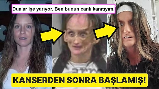 Kanser mi Oldu? Çocuklarını Kaybettikten Sonra Uyuşturucuya Başlayan Kadının Ders Niteliğindeki Trajik Öyküsü