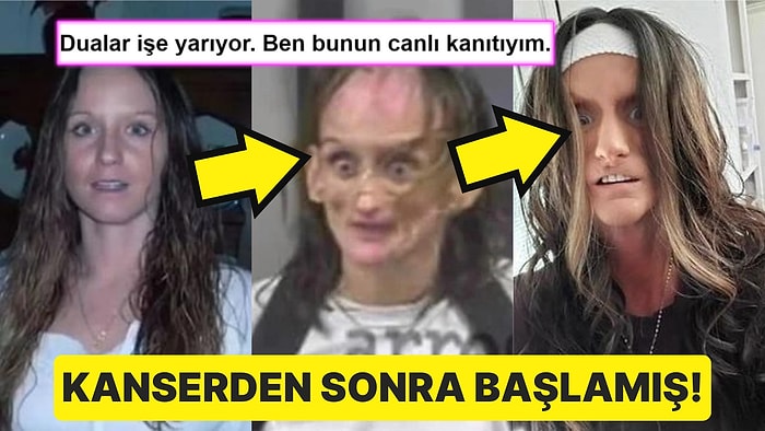 Kanser mi Oldu? Çocuklarını Kaybettikten Sonra Uyuşturucuya Başlayan Kadının Ders Niteliğindeki Trajik Öyküsü