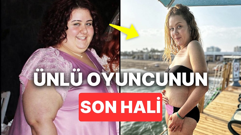 Güzeller Güzeli Oyuncu Aslı Samat 103 Kilo Verdikten Sonra Vücudundaki Değişimi Paylaştı