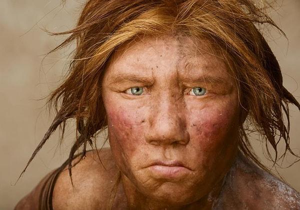Viking hastalığı için 61 genetik risk faktörü keşfedildi ve bunlardan üçünün Neandertallerden miras alındığı ortaya çıktı.