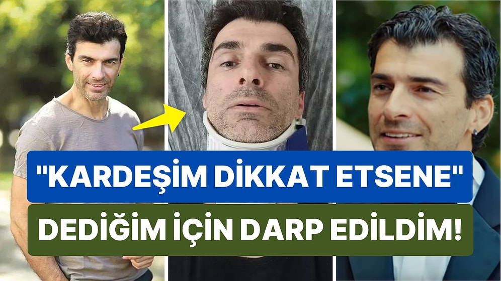 Yasak Elma Dizisiyle Gündeme Gelen Ünlü Oyuncu Özgür Özberk Trafikte Darp Edildi!