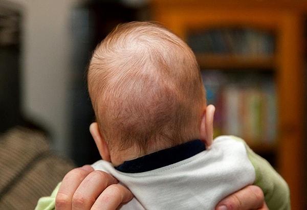 Arka bıngıldak bebeğin arkasında bulunan nokta. Arka bıngıldak genellikle 2 yaşına kadar kapanmıyor. Ancak bazı bebeklerde arka bıngıldak daha önce kapanabiliyor.