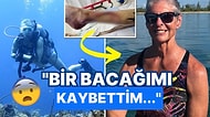 Köpek Balığı Saldırısına Uğrayan Kadın O Anları Anlattı: "Korku Filminden Bir Sahne Gibiydi..."