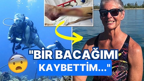 Köpek Balığı Saldırısına Uğrayan Kadın O Anları Anlattı: "Korku Filminden Bir Sahne Gibiydi..."