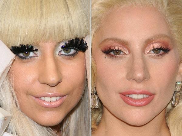 Bugünkü konumuz ise Lady Gaga'nın geçtiğimiz yıllardan bugüne kadar geçirdiği estetik işlemler...
