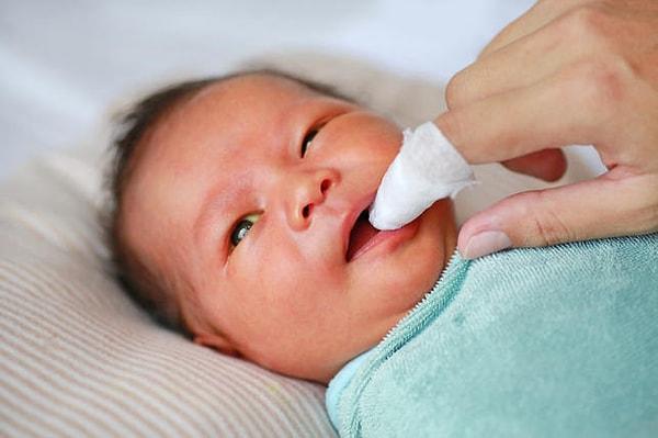 Bebeğinizin dilinde çıkan pamukçuklar varsa o zaman bebeğinizin ağzını düzenli olarak temizlemelisiniz. Bu sayede bebeğinizin ağzındaki bakterilerin büyümesi engellenir ve enfeksiyonun yayılması önlenir.