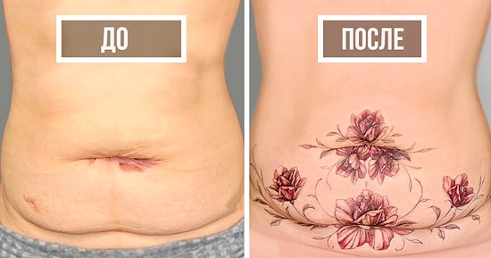 30 раз, когда люди попросили скрыть шрамы, и этот тату-мастер блестяще справился с этим