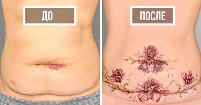 30 раз, когда люди попросили скрыть шрамы, и этот тату-мастер блестяще справился с этим