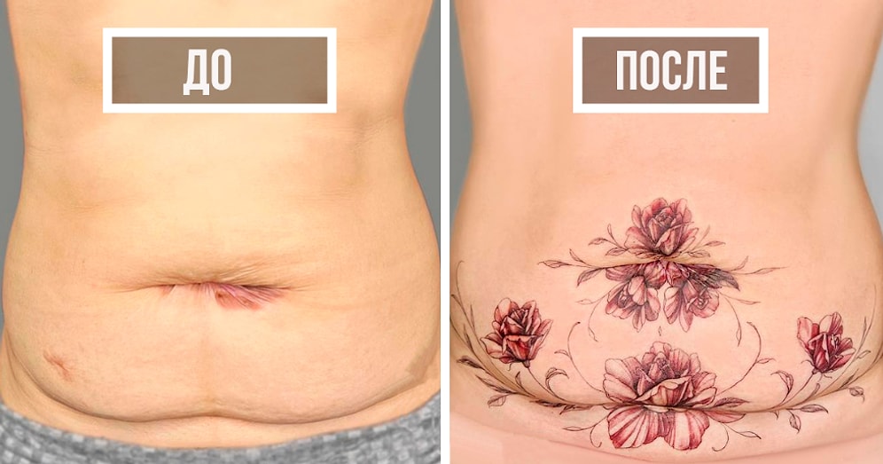 30 раз, когда люди попросили скрыть шрамы, и этот тату-мастер блестяще справился с этим