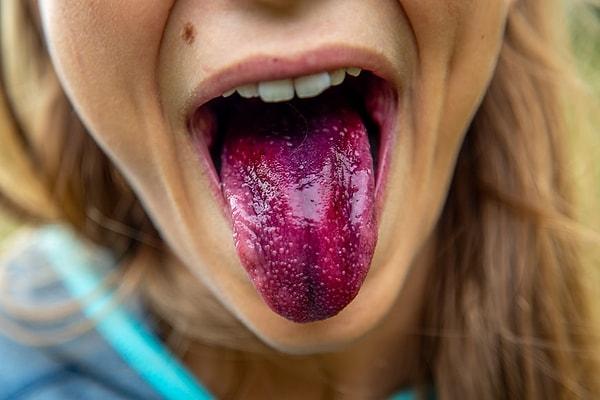 Dil, ağzımızın içinde bulunan ve tat alma duyusunu gerçekleştiren, kaslardan yapılmış bir organ.