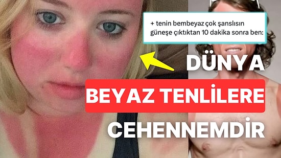 Yaz Geldi Diye Göbek Atanlara Karşı Güneşten Kızarmış Tavuğa Dönen Beyaz Tenlilerin Kahkaha Attıran İsyanları